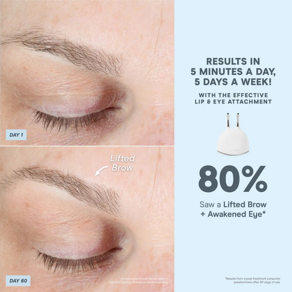 NuFACE® Trinity+ PRO - Complete Set