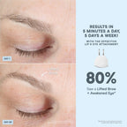 NuFACE® Trinity+ PRO - Complete Set