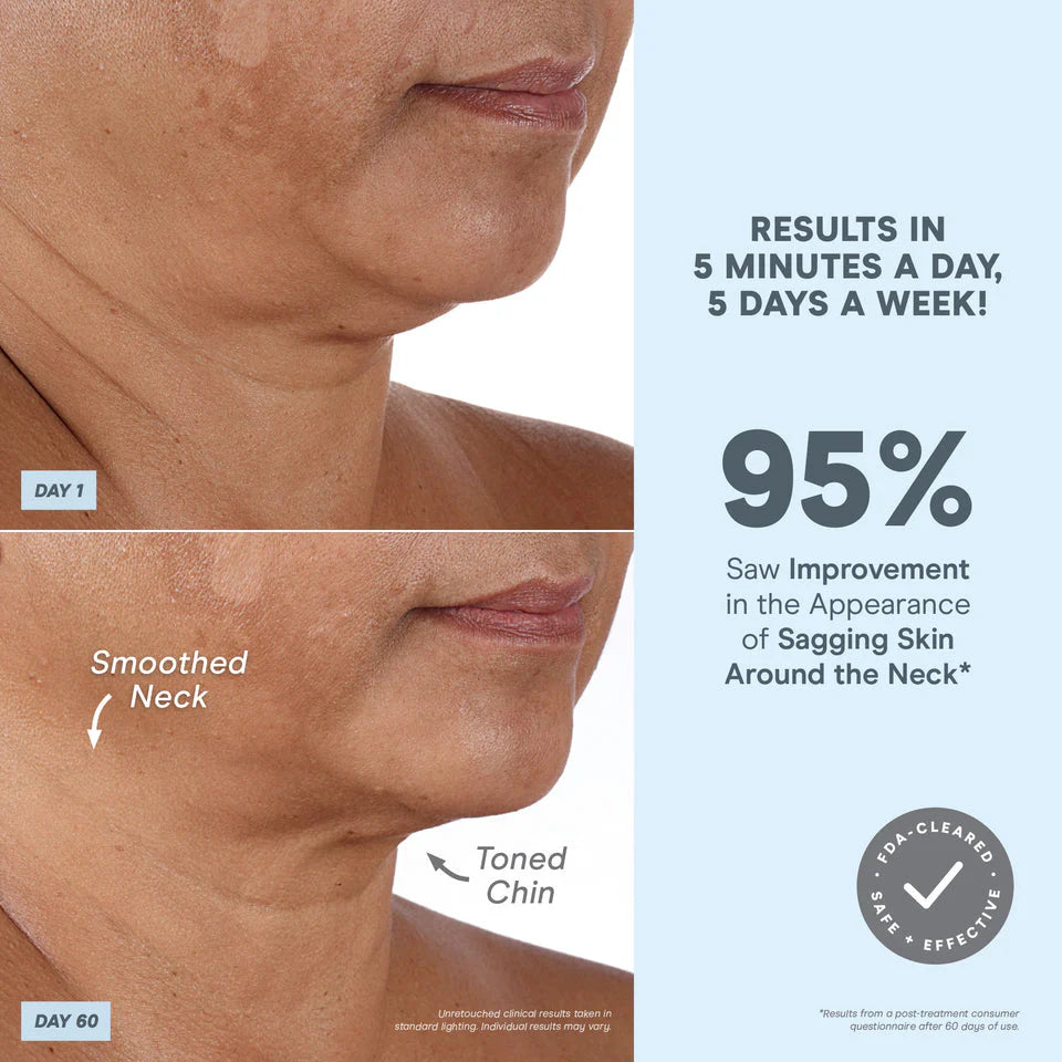 NuFACE® MINI+ Starter Kit - Smart Petite Facial Toning Kit