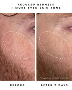 Nova 15% Vitamin C + Tumeric Brightening Serum