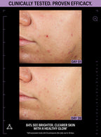 Azelaic & Kojic Advanced Clarifying Serum