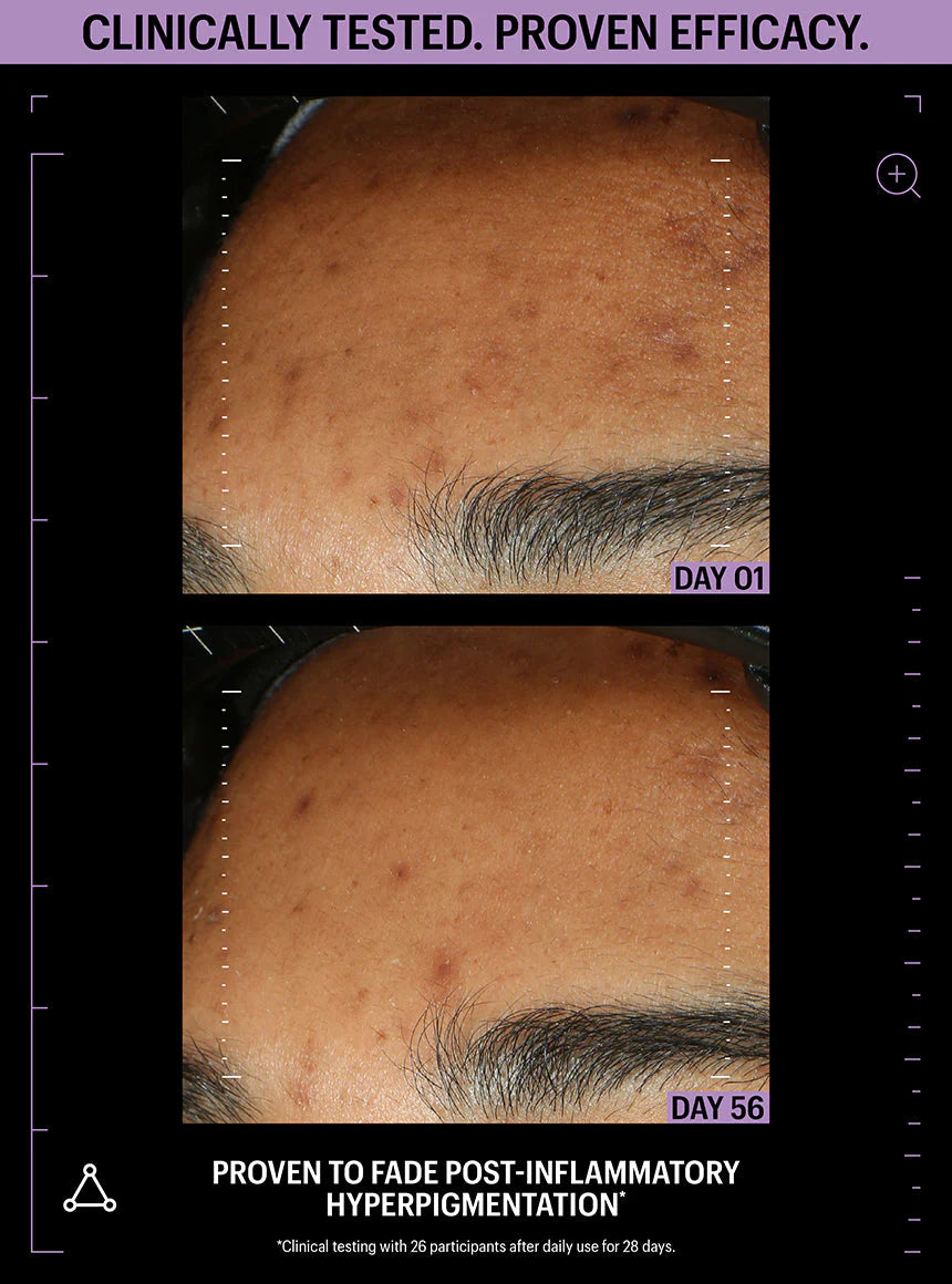 Azelaic & Kojic Advanced Clarifying Serum