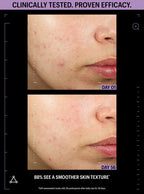 Azelaic & Kojic Advanced Clarifying Serum