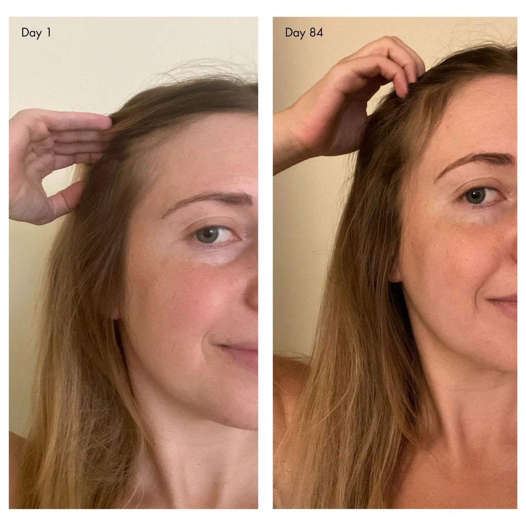 Holi (Growth) 84 Leave-In Hair Growth Scalp Spray