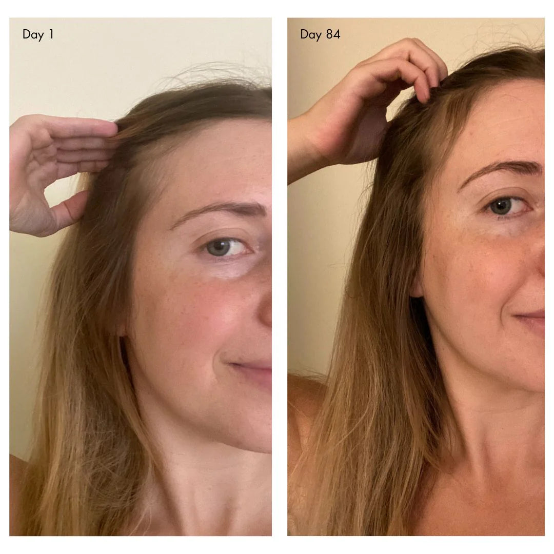 Holi (Growth) 84 Leave-In Hair Growth Scalp Spray