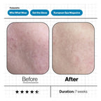 Skin Moisture IQ - Targets Dry Skin