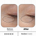 SYB6 Skin Youth Biome