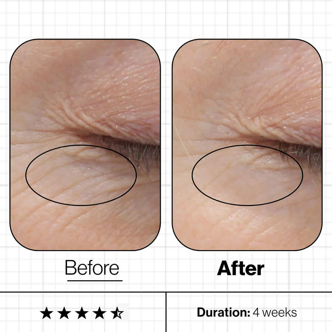 SYB6 Skin Youth Biome