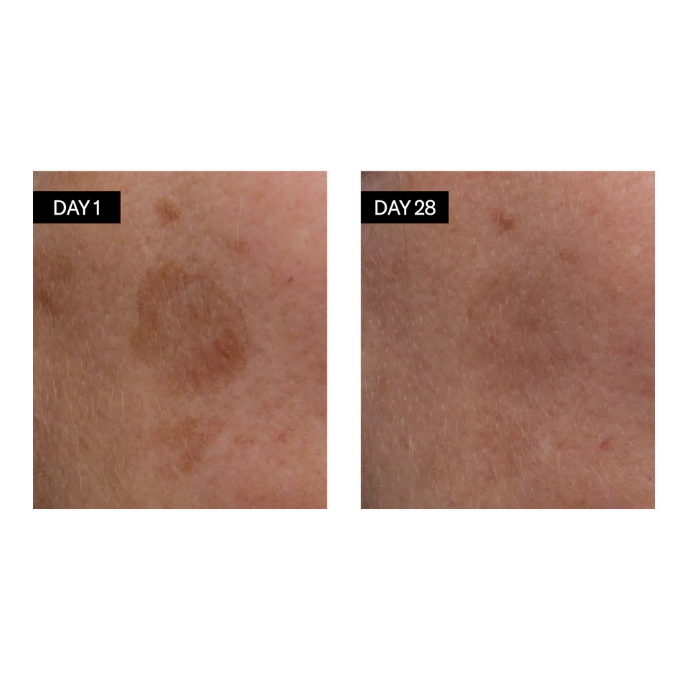 Brightening Serum - Vitamin C & E + Hyaluronic Acid