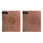 Brightening Serum - Vitamin C & E + Hyaluronic Acid