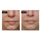 Clarifying Serum - Salicylic + Hyaluronic Acid