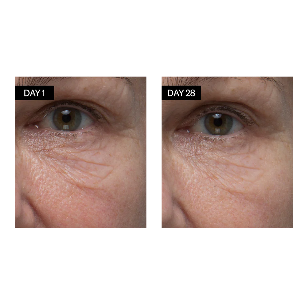 Retinol + Hyaluronic Acid Renewing Serum