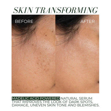 Clear + Bright Mandelic Drops